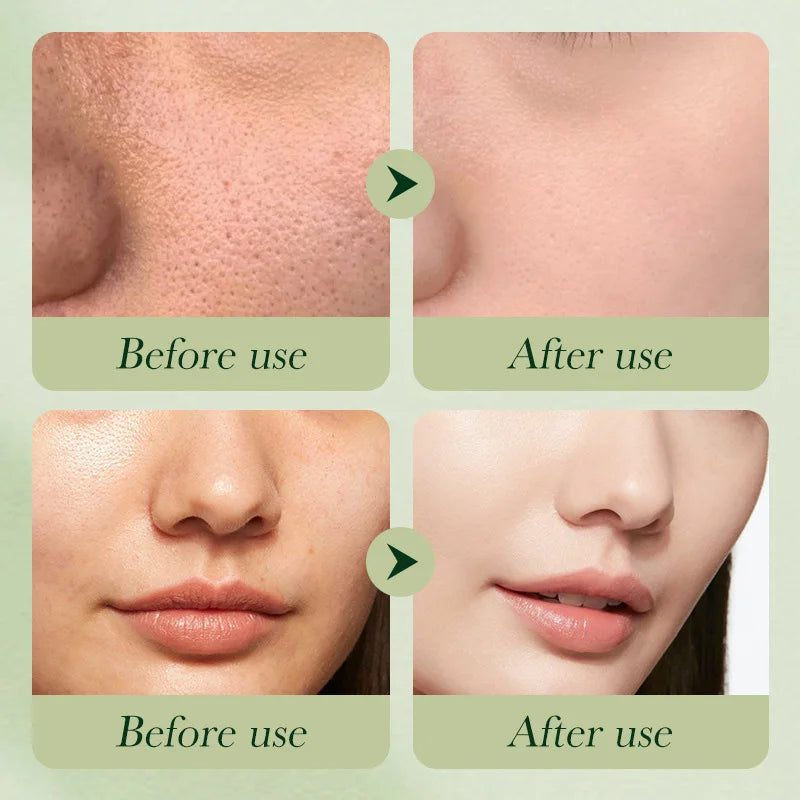 Before and after comparison of skin showing reduced pore visibility and a smoother, clearer complexion.