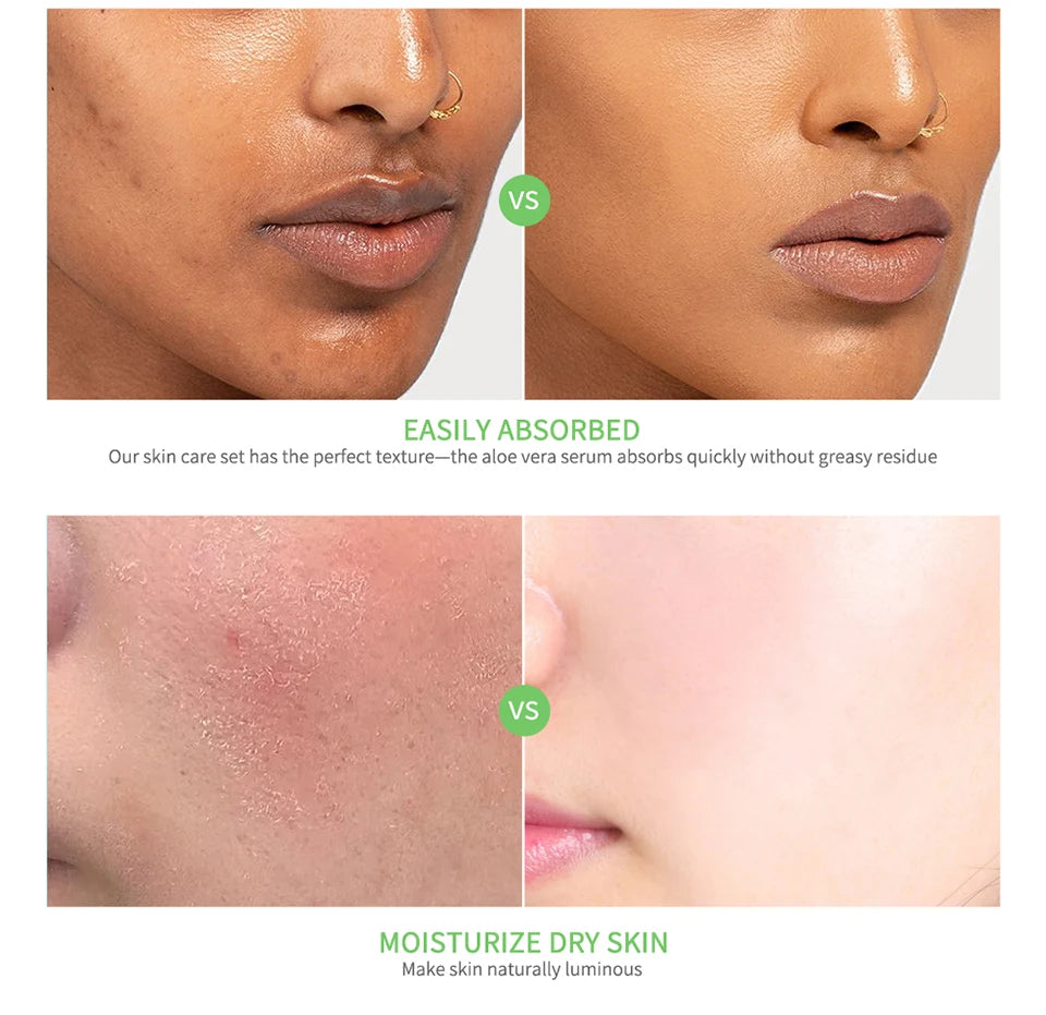 Before and after comparison of skin texture showing reduced blemishes and improved moisture for a luminous finish.
