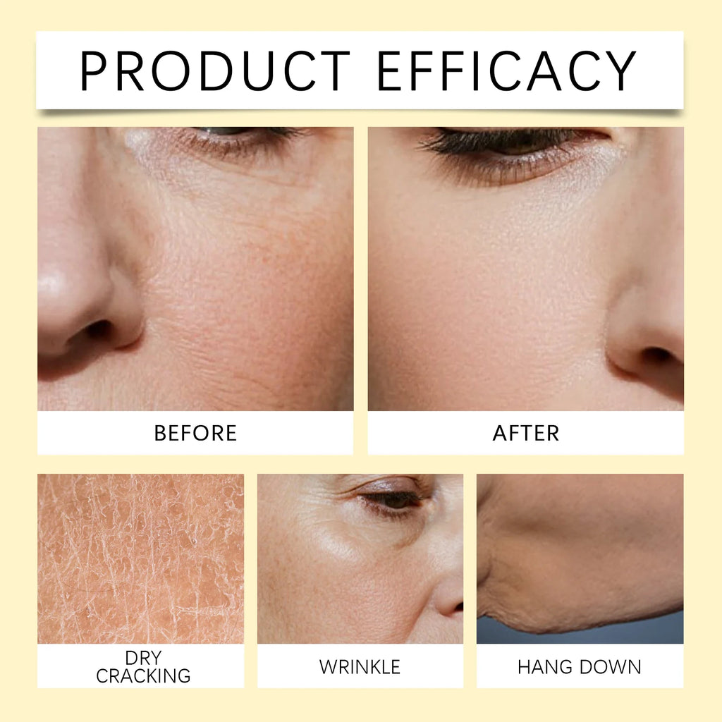 Before and after comparison of skin showing improvements in dryness, wrinkles, and sagging for a smoother complexion.