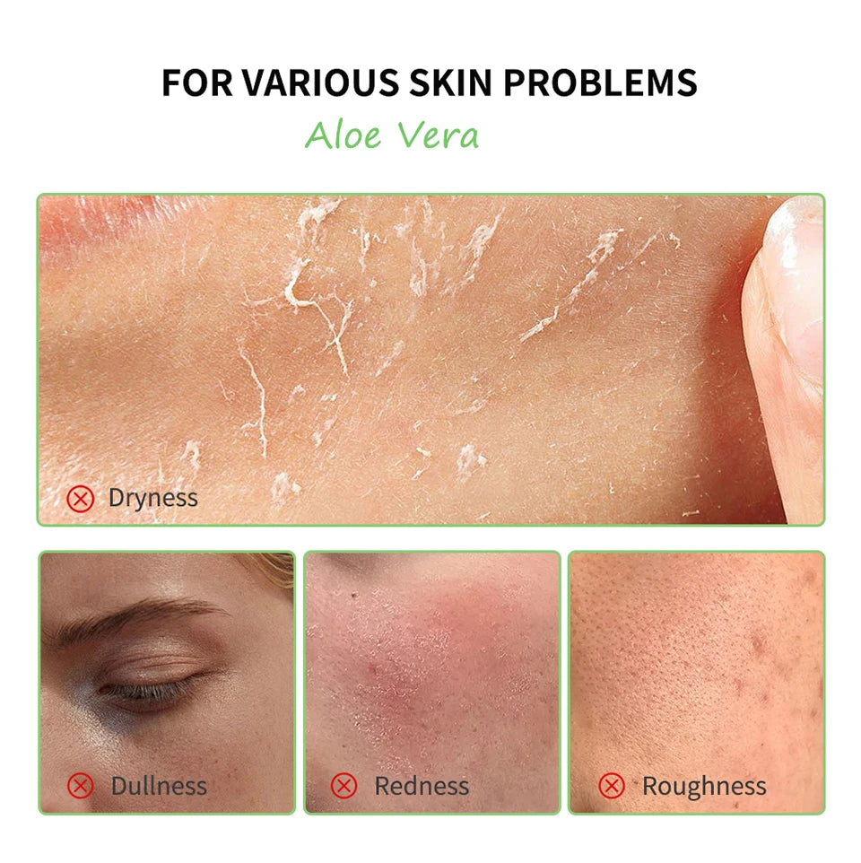 Close-up images showing skin conditions like dryness, dullness, redness, and roughness, with an Aloe Vera text heading.