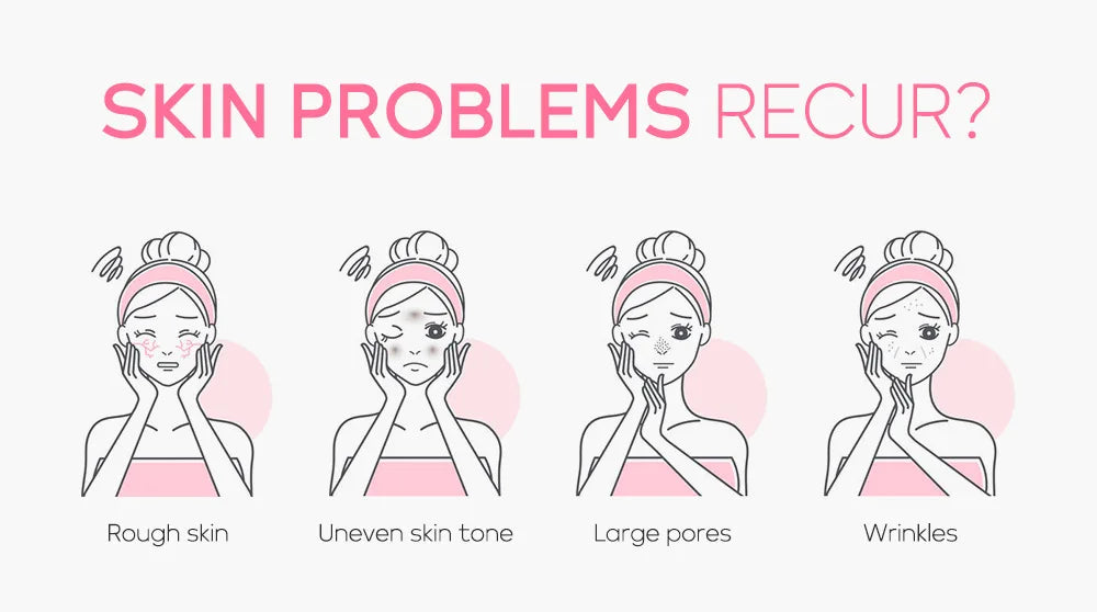 Infographic showing four illustrations of women with common skin concerns: rough skin, uneven tone, pores, and wrinkles.