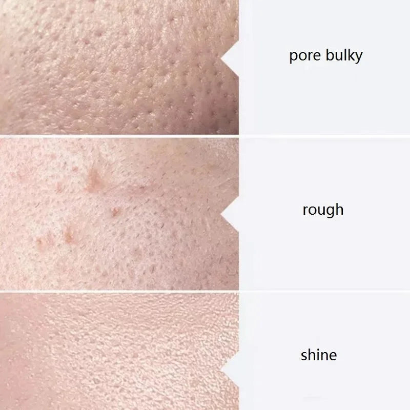 Three close-up skin images illustrating common concerns: large pores, rough texture, and oily shine.