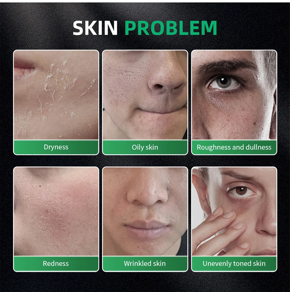Six-panel graphic showing common skin concerns: dryness, oiliness, roughness, redness, wrinkles, and uneven skin tone.