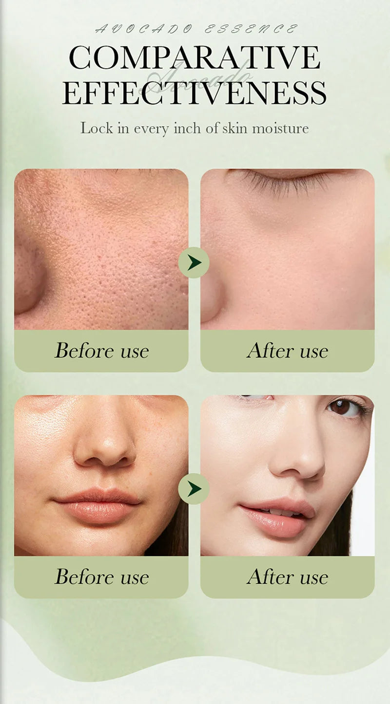 Before and after comparison of skin texture and hydration, showing smoother, clearer skin after using avocado essence.