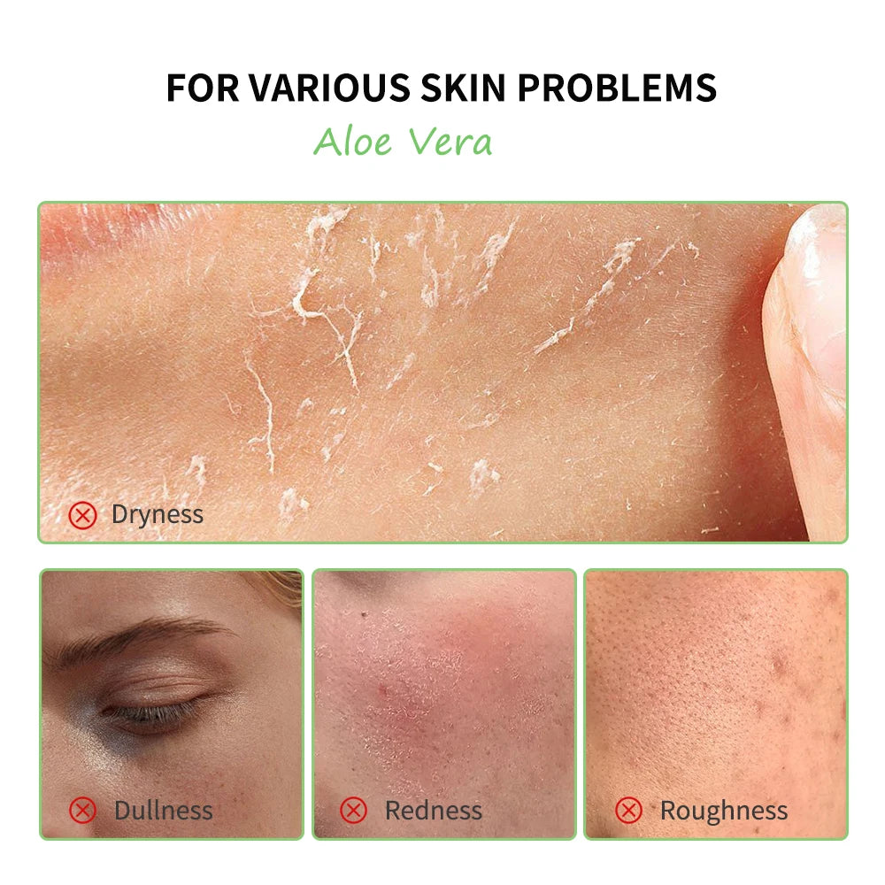 Close-up images showing skin dryness, dullness, redness, and roughness, highlighted as problems for aloe vera treatment.