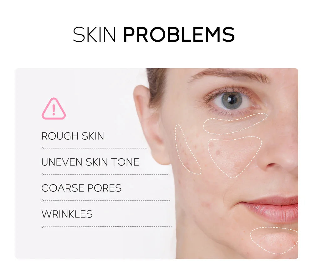 Infographic showing common skin concerns: rough skin, uneven tone, coarse pores, and wrinkles on a woman’s face.