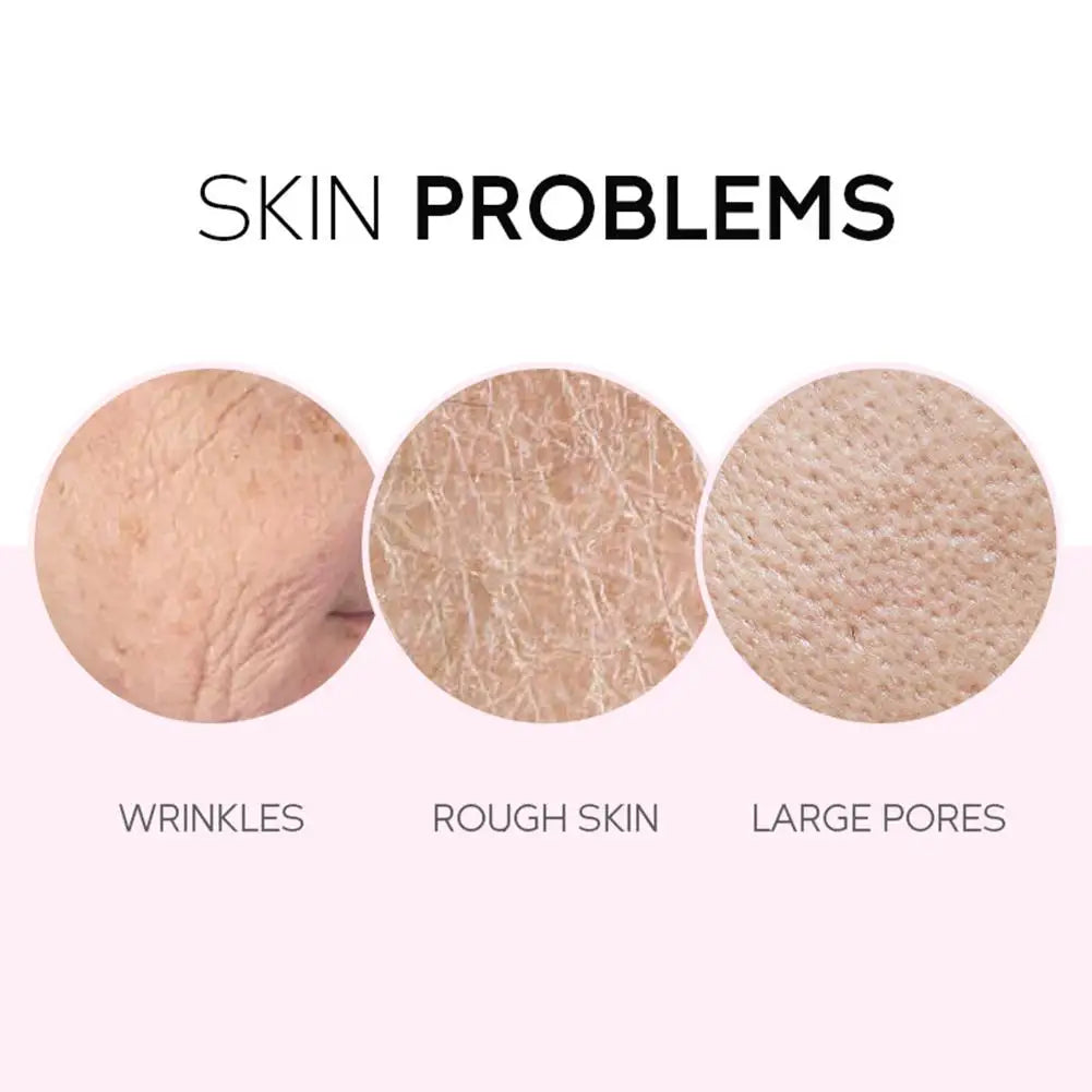Graphic showing three skin close-ups labelled as wrinkles, rough skin, and large pores.