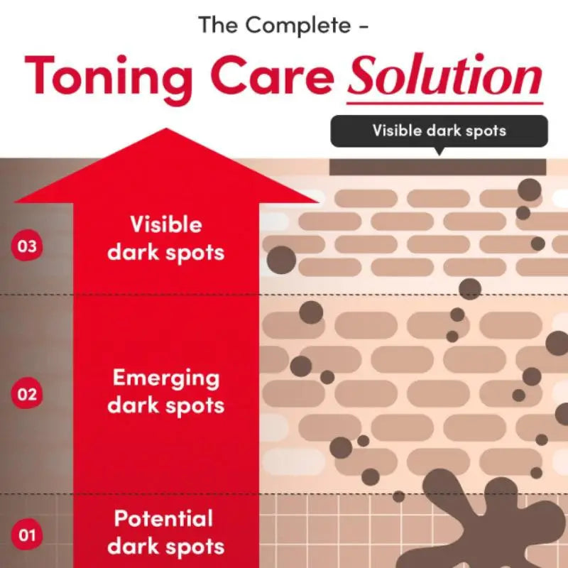 Infographic showing three stages of dark spot formation in skin, from potential to visible, with a red upward arrow.
