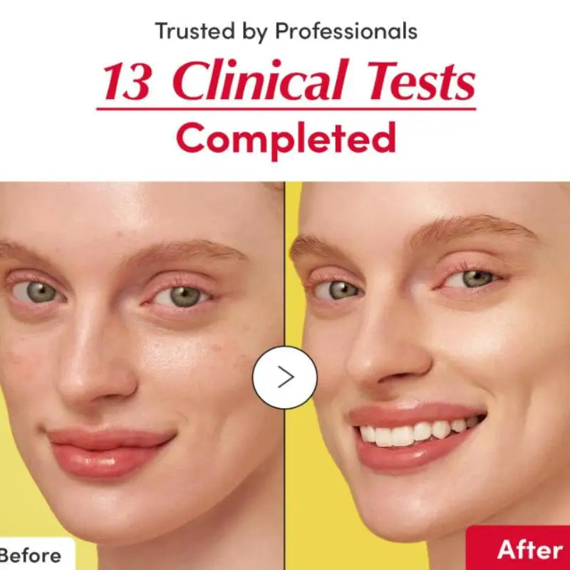 Before and after comparison of a woman's face showing skincare results with text highlighting 13 clinical tests.