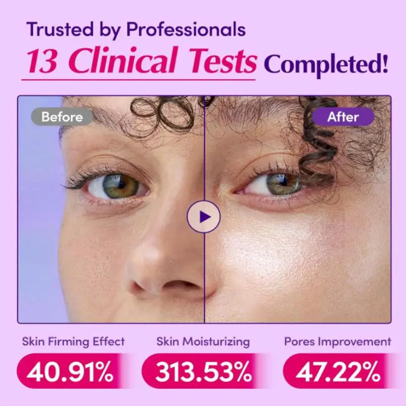 Before and after photo comparison showing improved skin texture, hydration, and pore appearance after clinical testing.